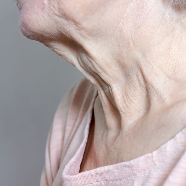 picture of neck