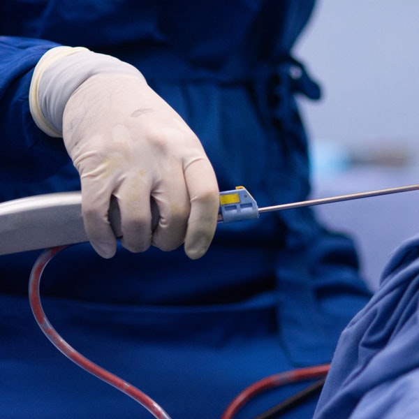 Pictures of hand with glove