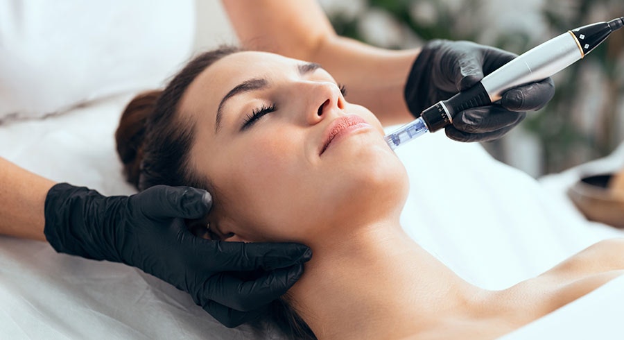 Woman receiving microneedling on chin