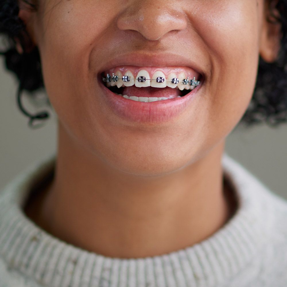 Young person with traditional braces
