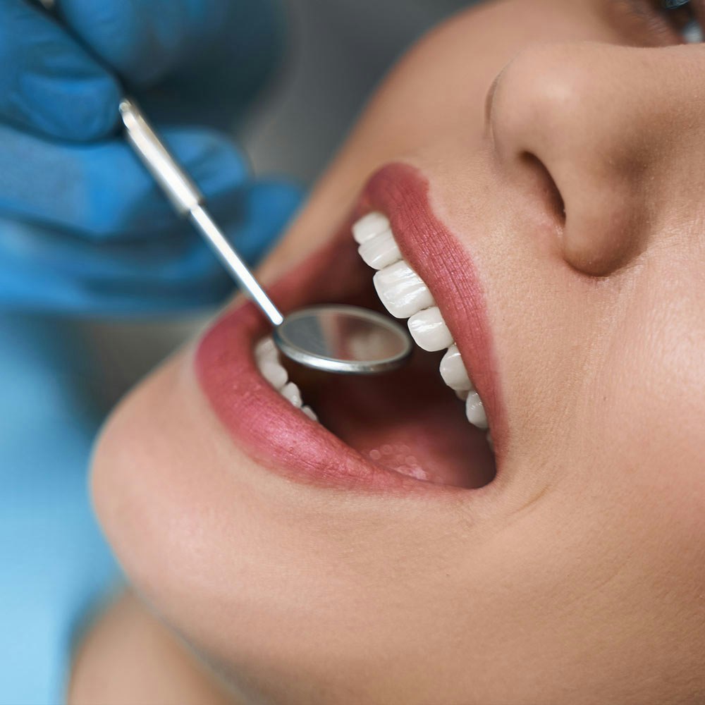 Veneers on dentist patient