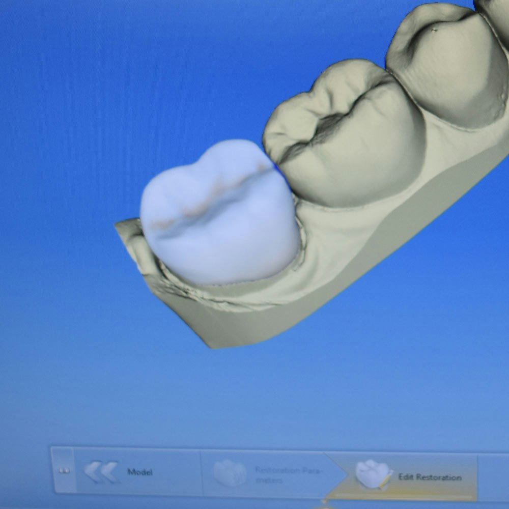 CEREC machine