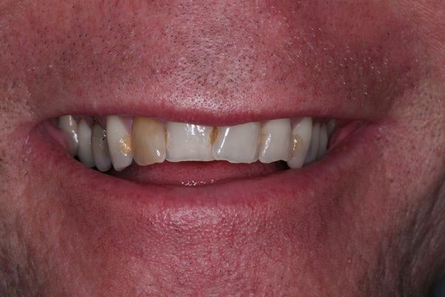 Before smile makeover