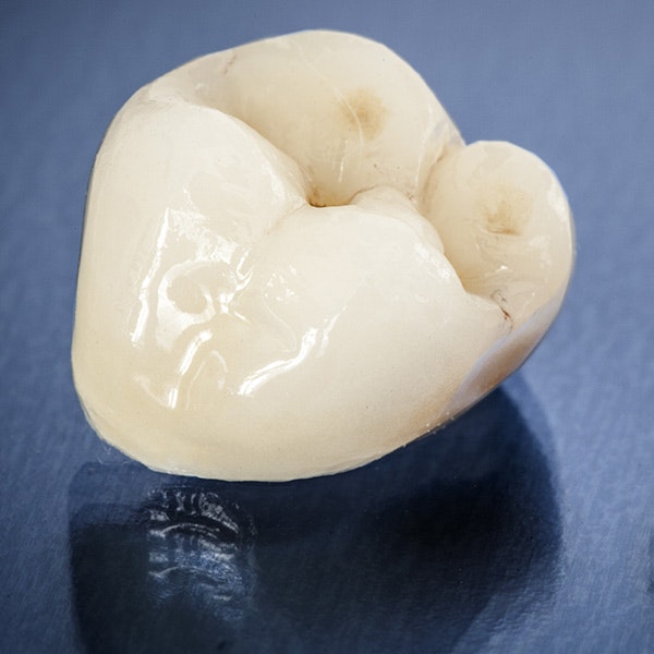 dental crown close-up