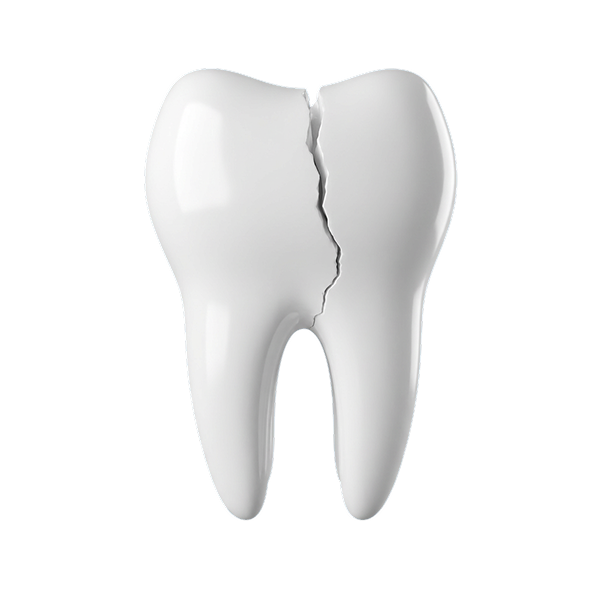 cracked tooth
