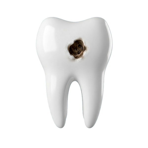 tooth decay