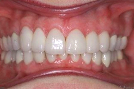 a repaired smile