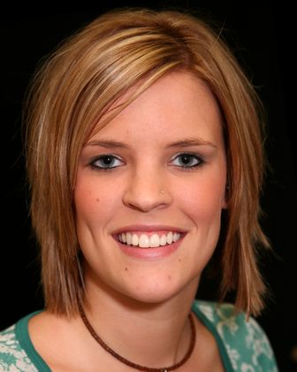 Dr. Everett E. Heringer's patient veneer placement