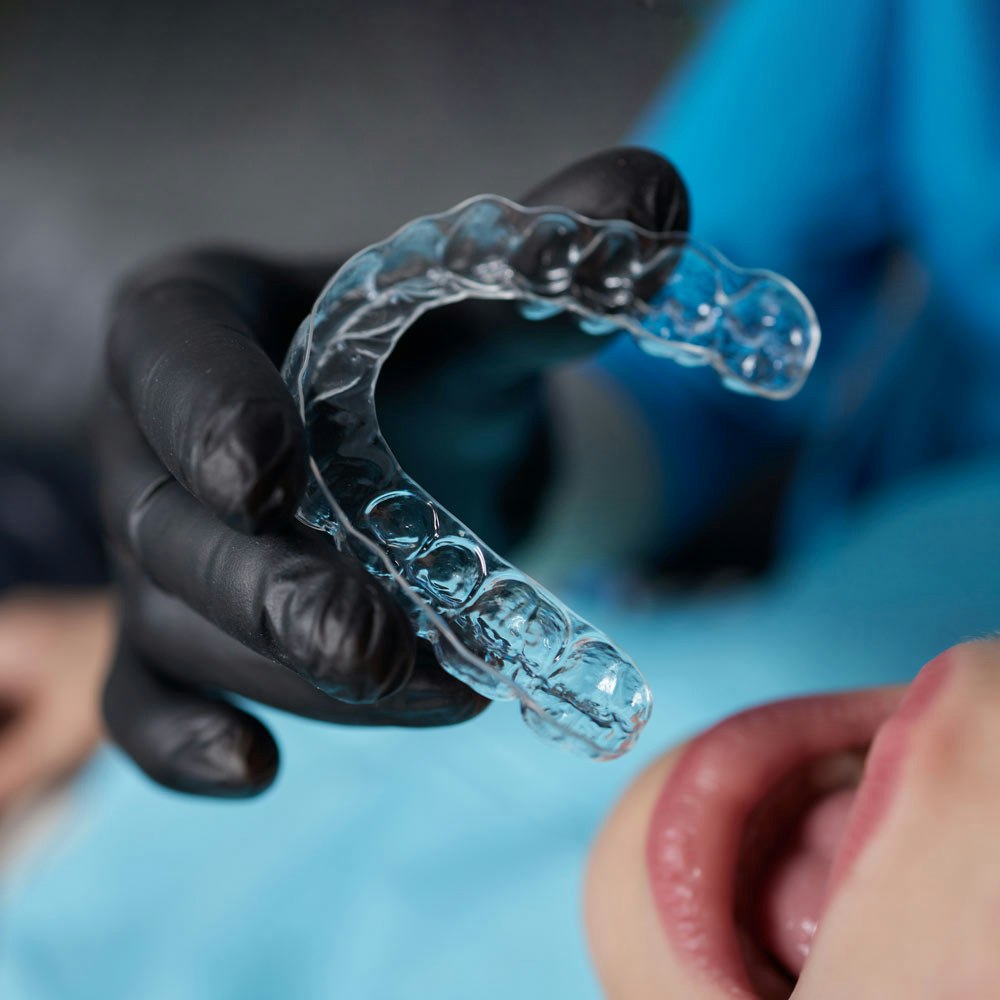 Invisalign tray