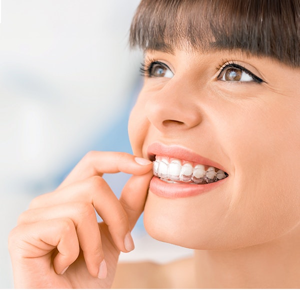 Young woman putting in an Invisalign aligner