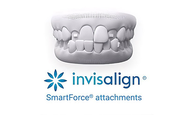 SmartForce® Attachments