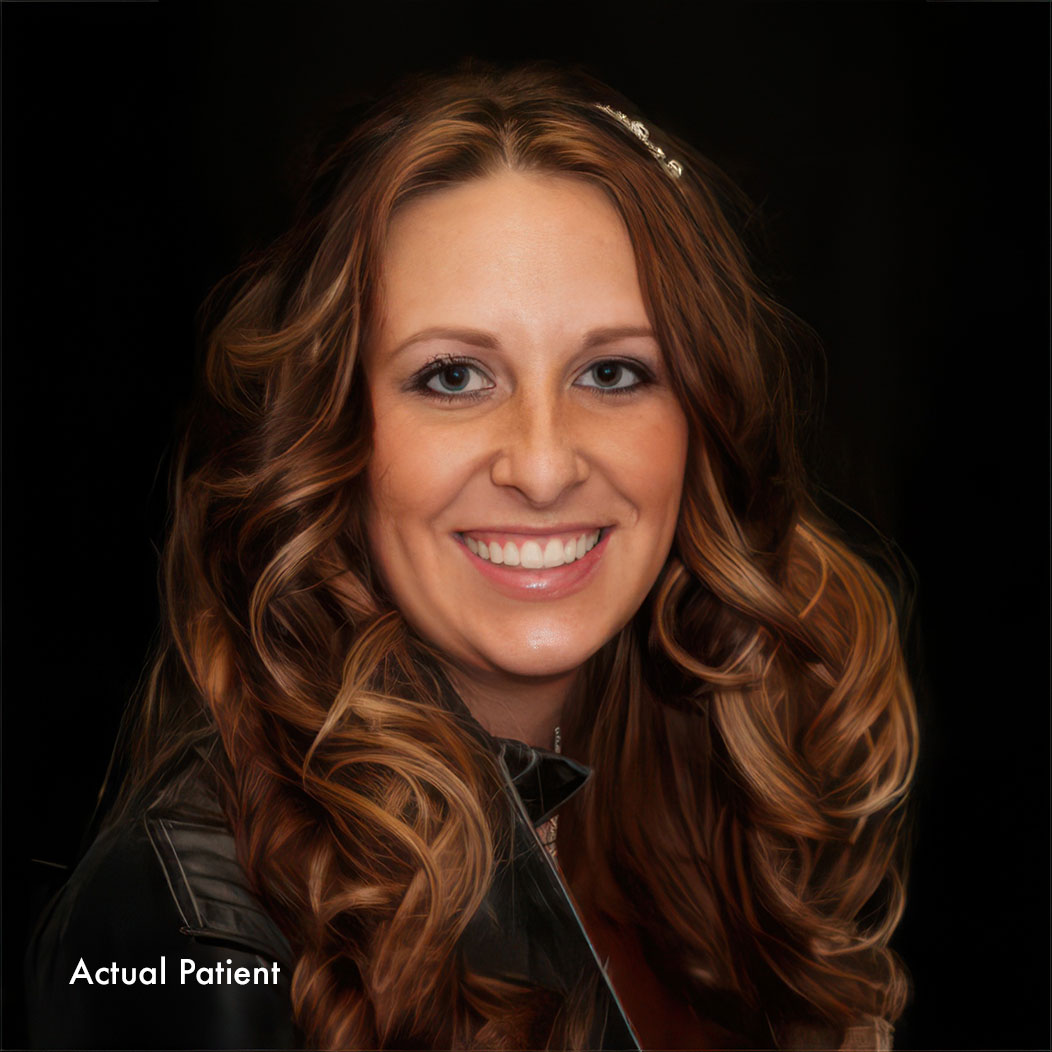 our real Bismarck patient