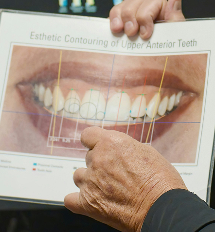 dental analysis