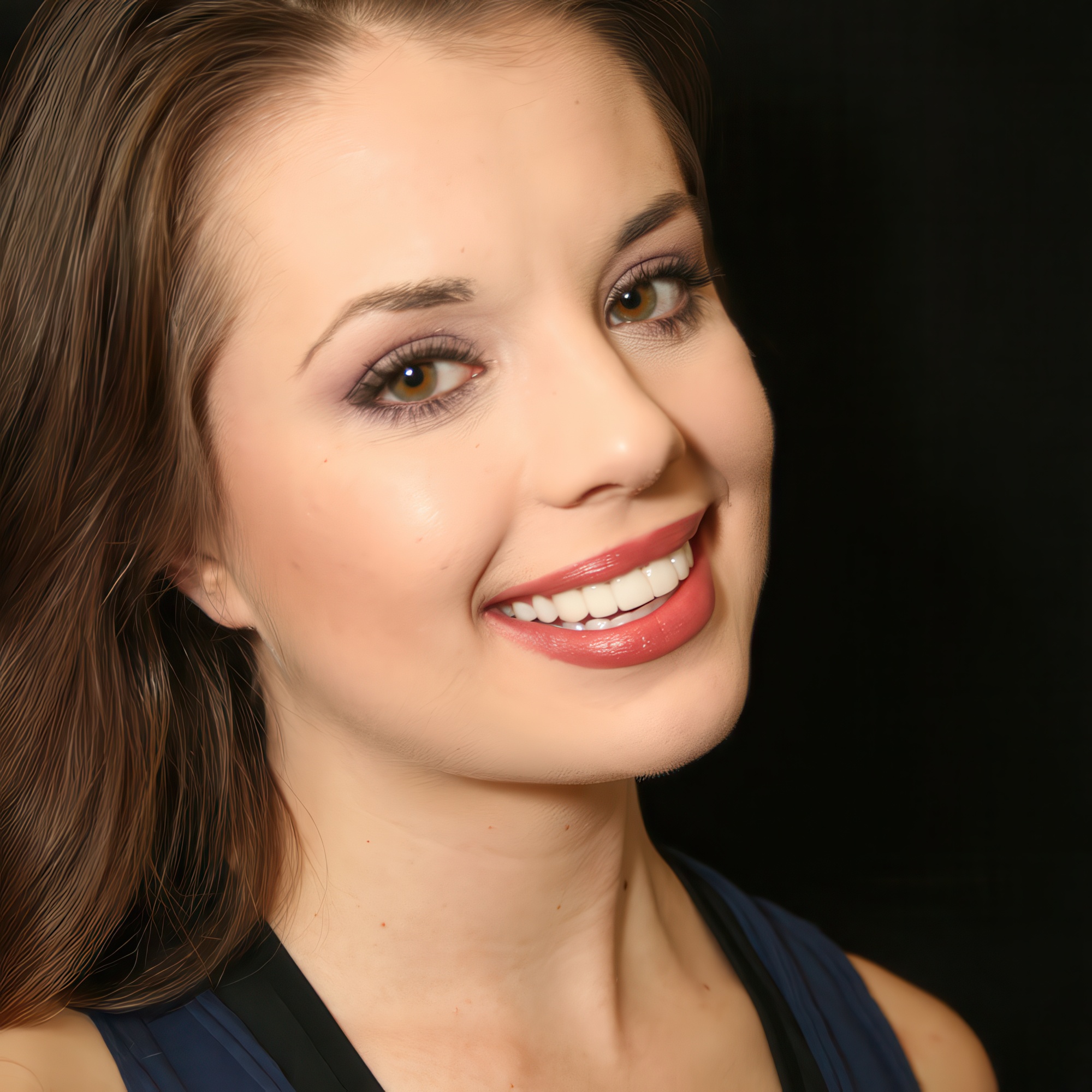 Case 3 Porcelain Veneers