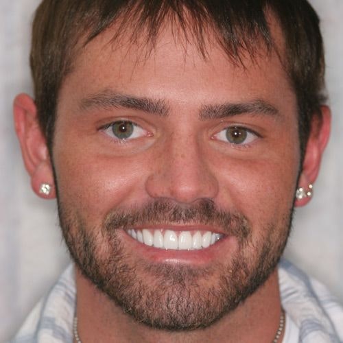 Smiling man with white teeth