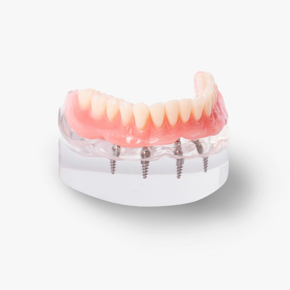 implant dentures