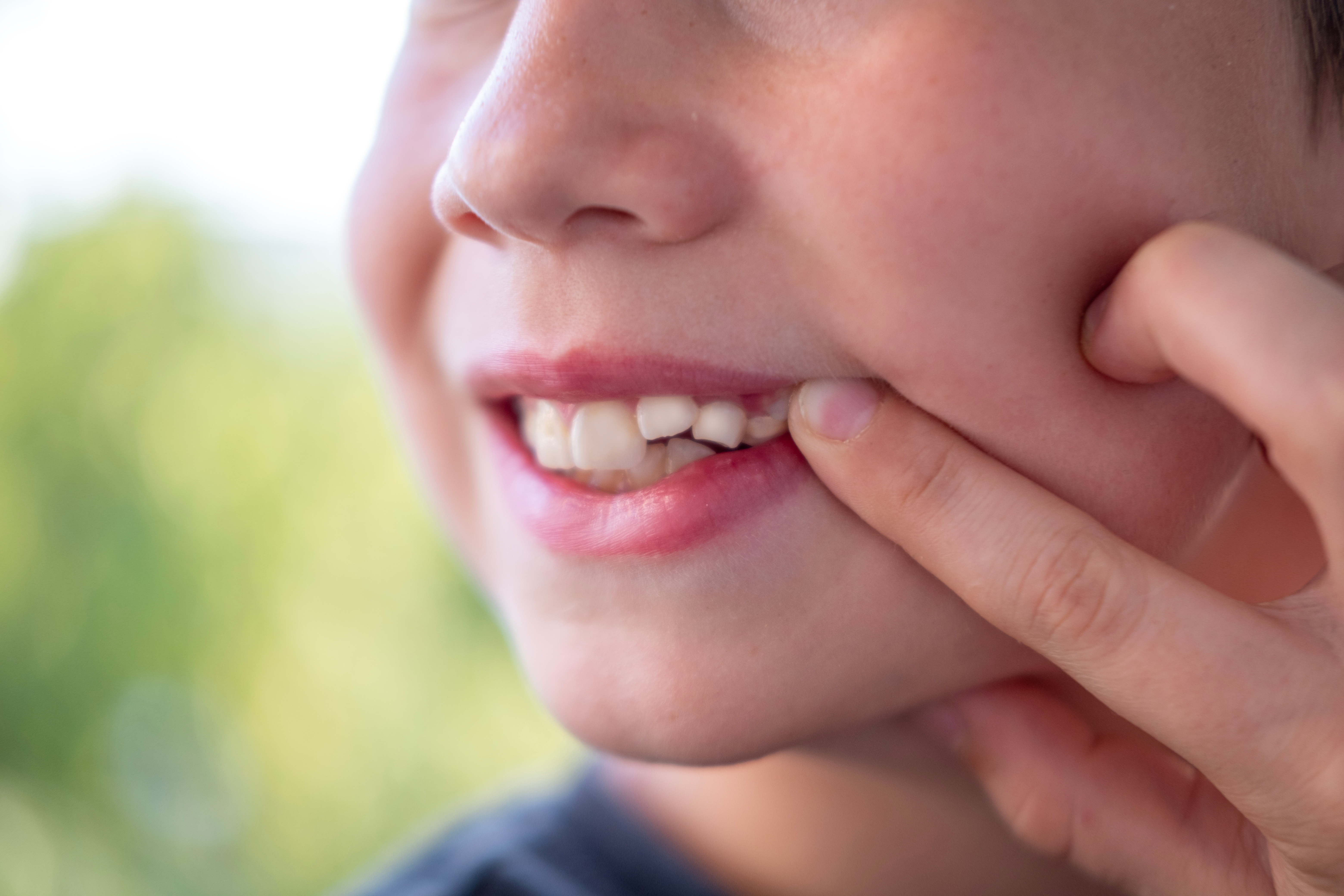Close-up of young boy's crooked teeth
