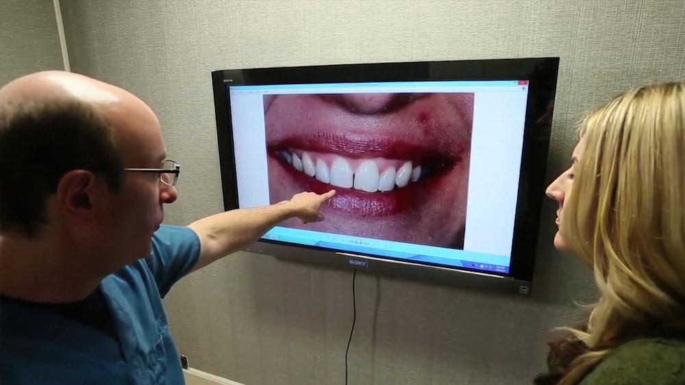 smile design software