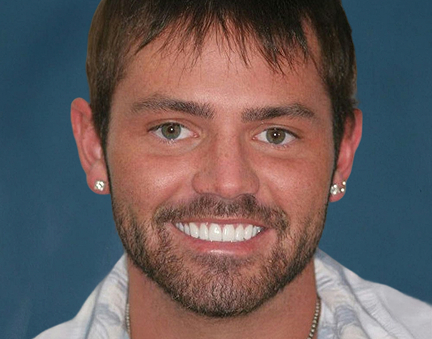 Smiling man with white teeth