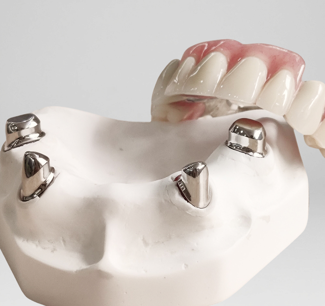 Implant denture