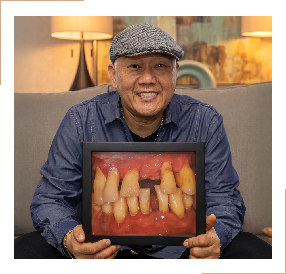 Real patient holding framed photo of his teeth before treatment