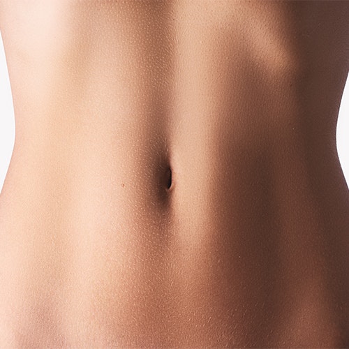 a woman's belly button after a tummy tuck