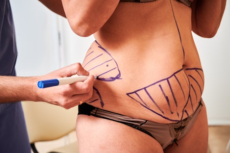 woman being prepped for surgery