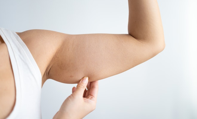 Woman pinching underarm