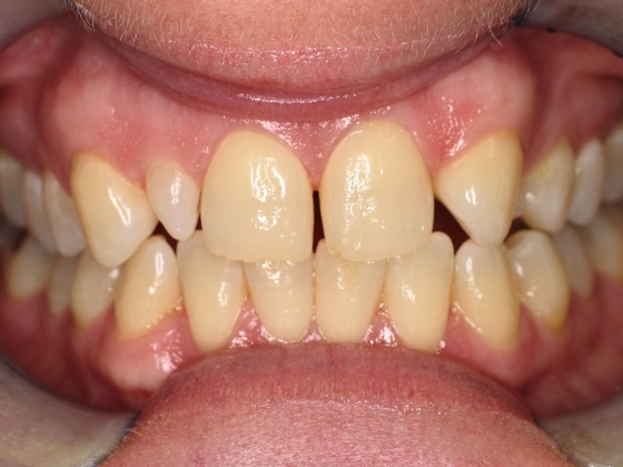 Before esthetic dentistry