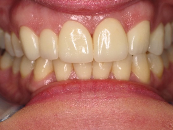 After esthetic dentistry