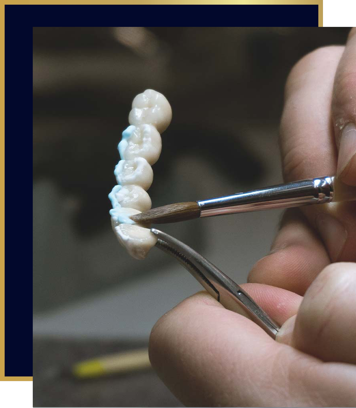 technician creating a traditional dental bridge