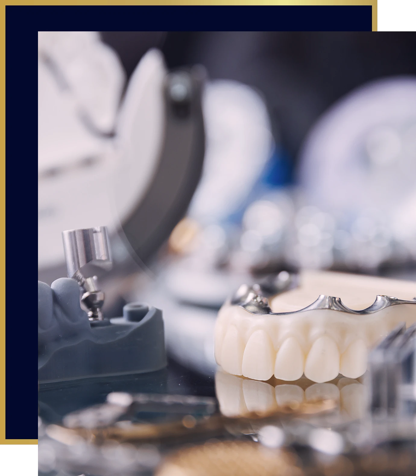 Close-up of a dental implant model and a partial denture with metal framework on a reflective surface, with dental tools blurred in the background.