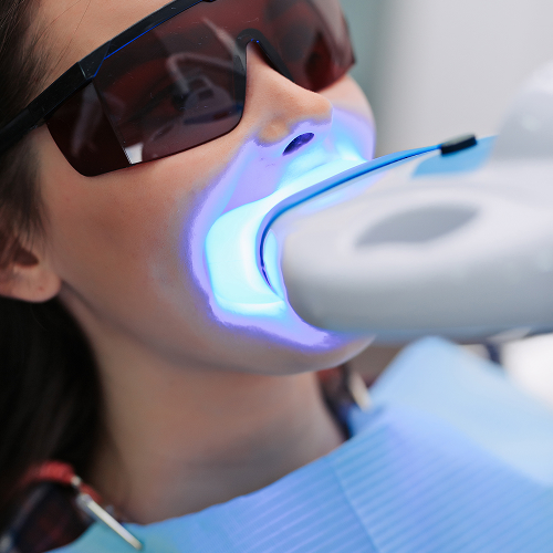 teeth whitening machine