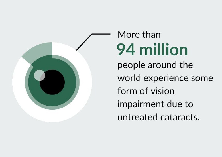 More than 94 million people around the world experience some form of vision impairment due to untreated cataracts