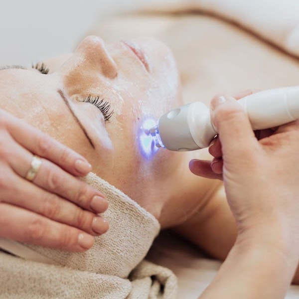Laser Skin Resurfacing