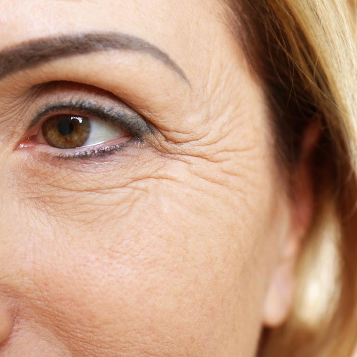 close-up of woman's crow's feet