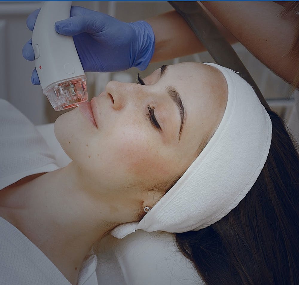 Woman receiving laser skin resurfacing on face