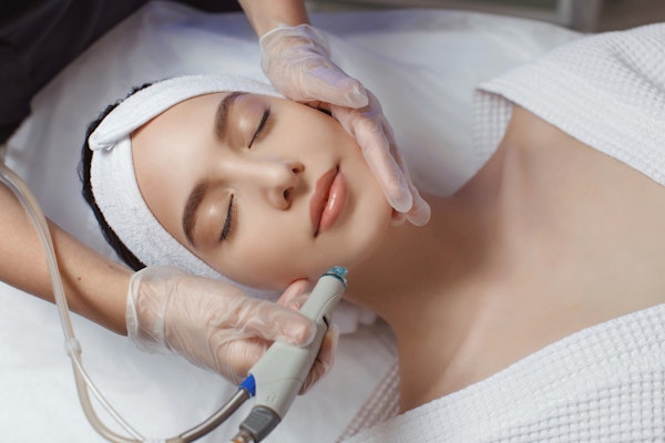 woman receiving microdermabrasion treatment
