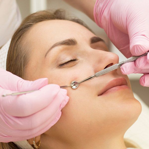 doctor popping pimples