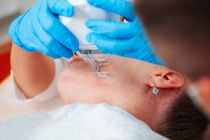 Woman receiving laser treatment