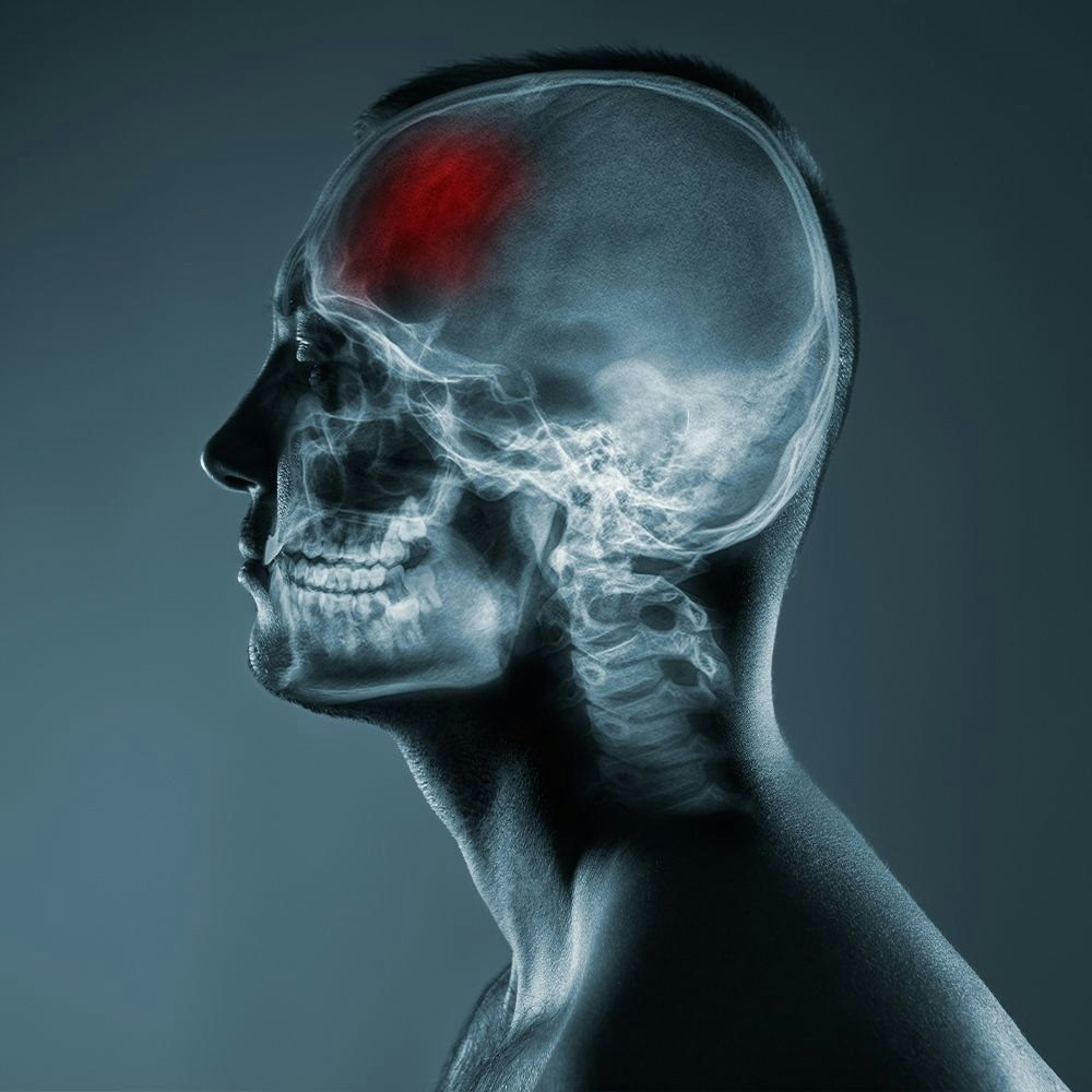 Brain highlighted within human figure