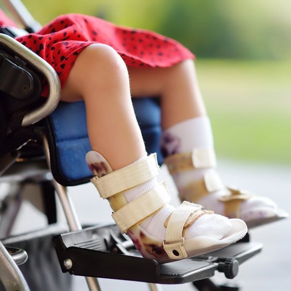A child in a wheelchair wearing surgical boots