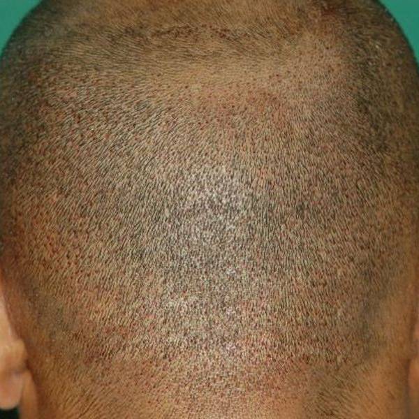 Back of man's head with short hair