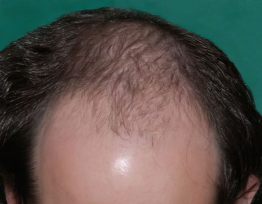 Dr. Konior