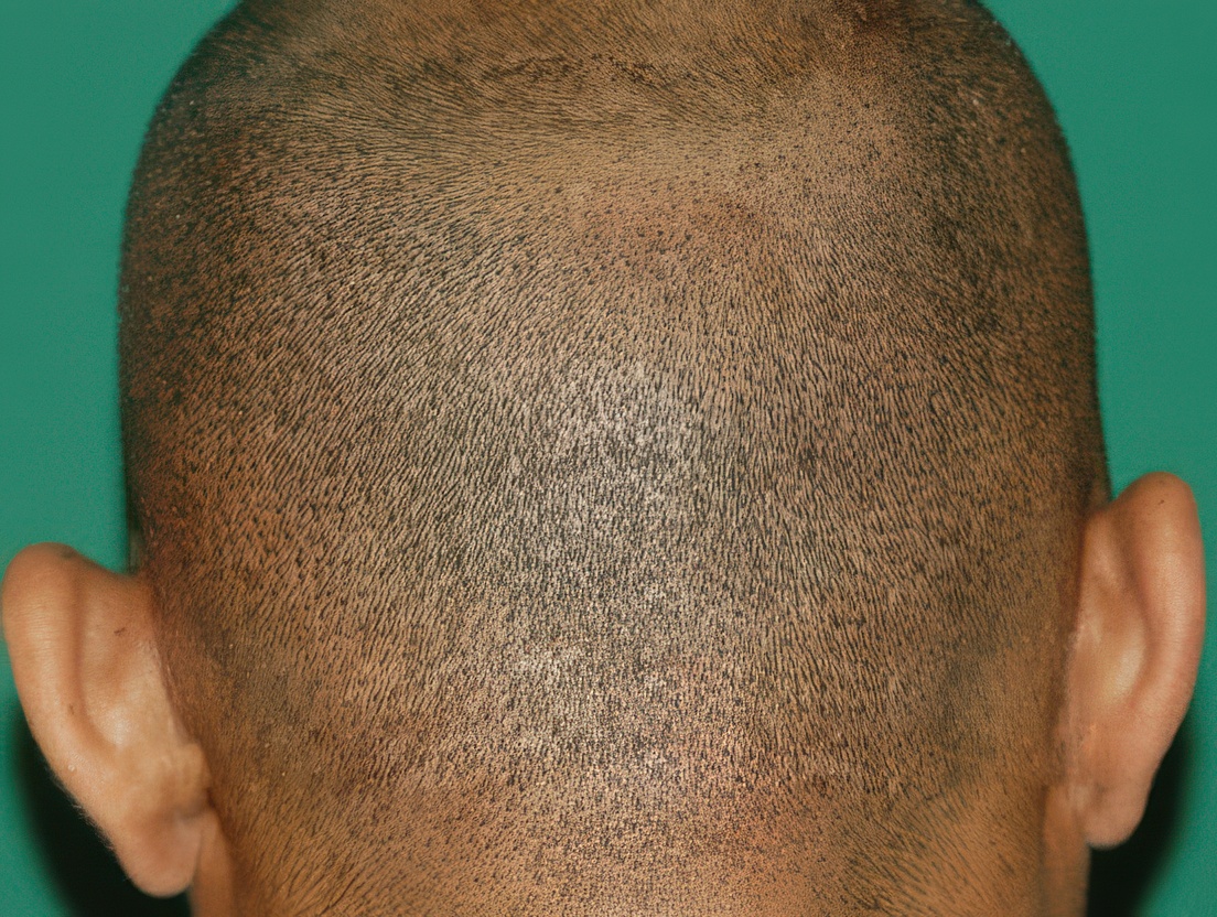 Back of man's shaved head