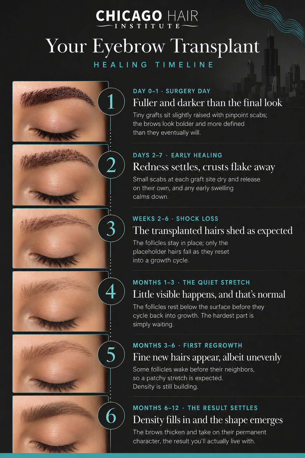 eyebrow transplant timeline