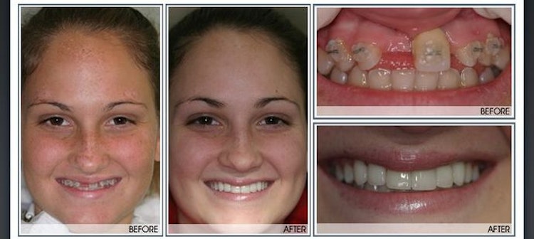 before and after dental care