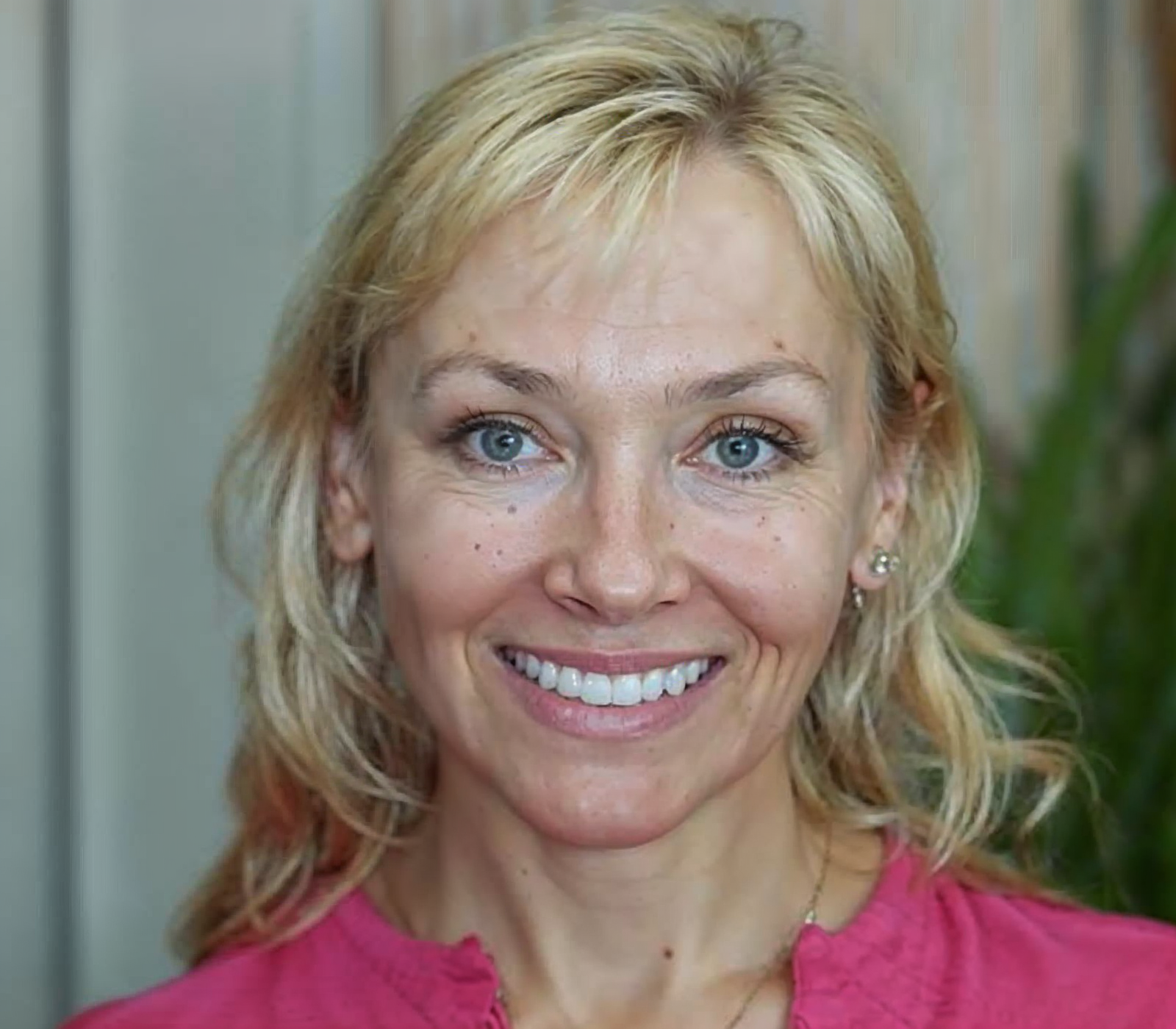 After full mouth reconstruction