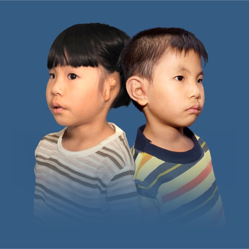 young patient before and after ear reconstruction