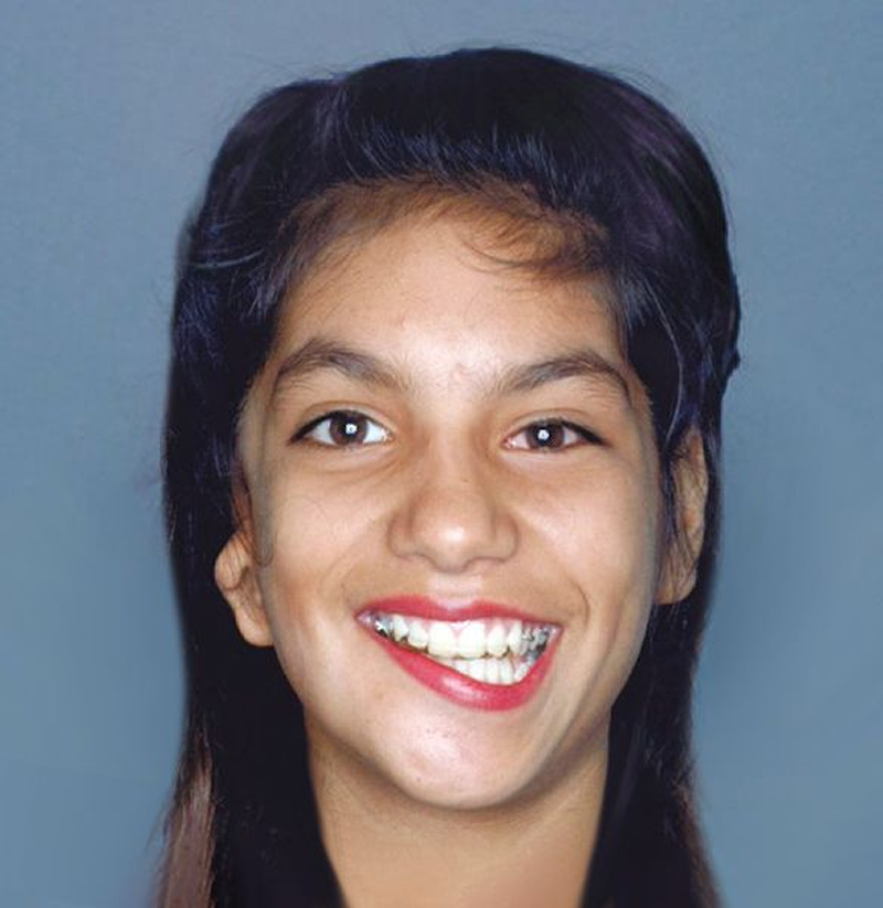 Patient with facial asymmetry